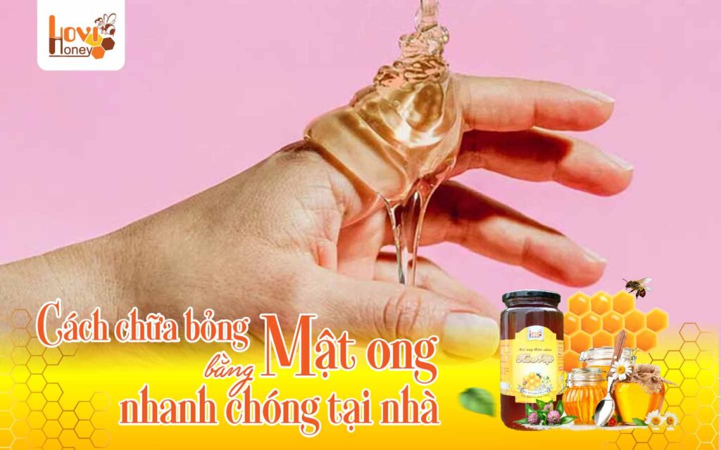 Cách chữa bỏng bằng mật ong nhanh chóng tại nhà